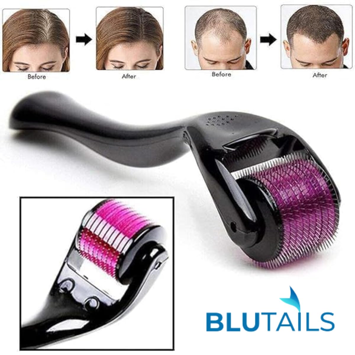 540 Titanium Microneedle Derma Roller Micro Needle Skin Care For Hair Loss Beard